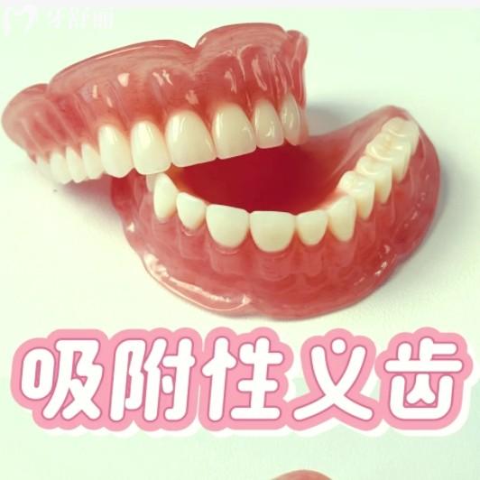全口吸附性義齒使用壽命有多久？還有做假牙前必看優(yōu)缺點整理