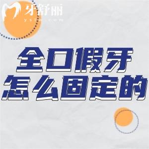全口假牙是怎么固定的?盤點(diǎn)三大全口假牙種類及安裝原理[附圖片]