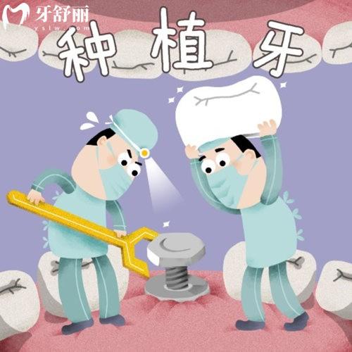 濟(jì)南種植牙2025收費標(biāo)準(zhǔn)表:快速查詢單顆/單口/全口種植牙價格明細(xì)