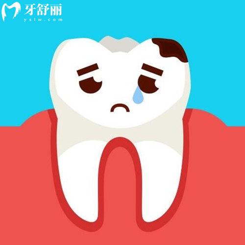 了解牙齒齲壞六種洞型圖片和介紹,齲齒不能自愈,請(qǐng)及時(shí)進(jìn)行治療