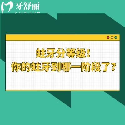 蛀牙分等級(jí)！你的蛀牙到哪一階段了？分為淺齲-中齲-深齲-牙髓炎