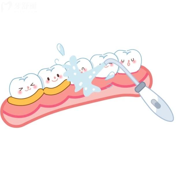 超聲波洗牙和噴砂洗牙區(qū)別？適合人群與價(jià)格對(duì)比