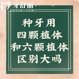 全口種牙用四顆植體和六顆植體區(qū)別大嗎?看看正規(guī)牙醫(yī)怎么說?