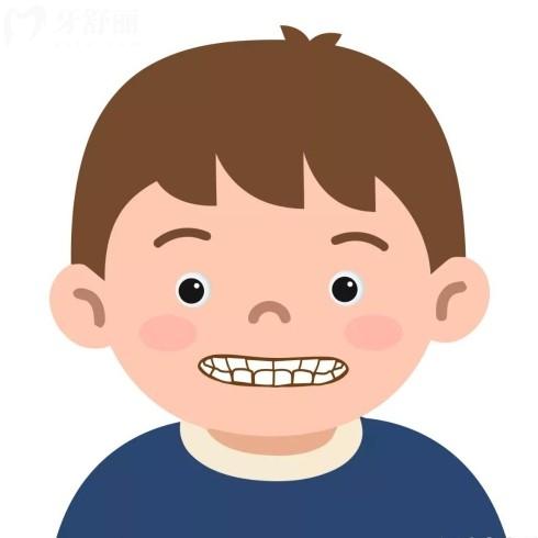 這5類牙齒問題別拖延！孩子矯正黃金期錯過就晚了