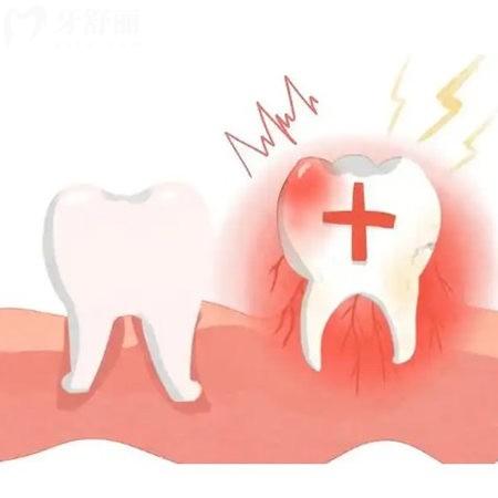 牙齦炎和牙齦癌的區(qū)別是啥?這里有早期鑒別診斷及治療方案請查收