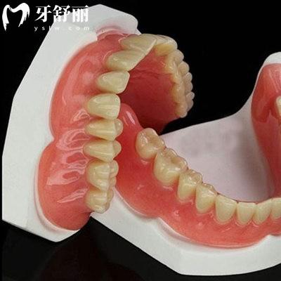吸附式義齒全攻略:日常護(hù)理秘籍/使用人群/使用壽命/價(jià)格表全包含