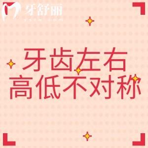 牙齒左右高低不對(duì)稱正常嗎？別小瞧不正常哦，背后的原因大著呢！