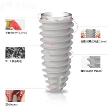 韓國紐百特種植體質(zhì)量如何？從材質(zhì)、技術(shù)及適用人群各方面解讀