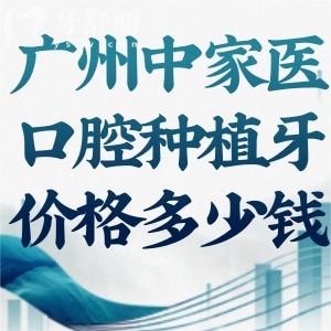?我嘞個(gè)豆!廣州中家醫(yī)口腔種植牙298元是真的!詳細(xì)種牙價(jià)格表看過絕不錯(cuò)過