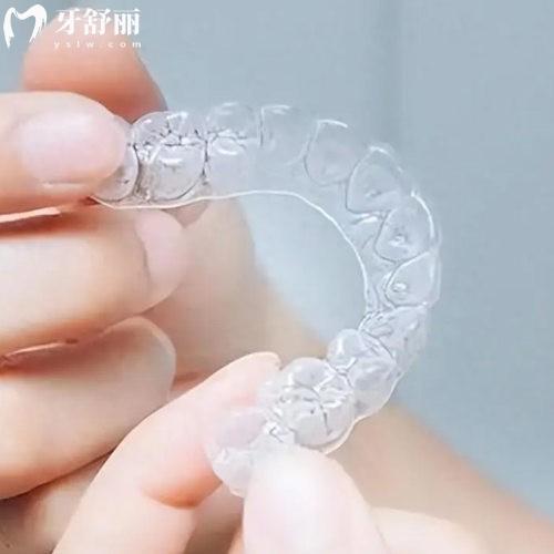 2025蘇州口腔醫(yī)院牙齒矯正收費(fèi)標(biāo)準(zhǔn)表:兒童矯正5800+成人矯正8000-30000+