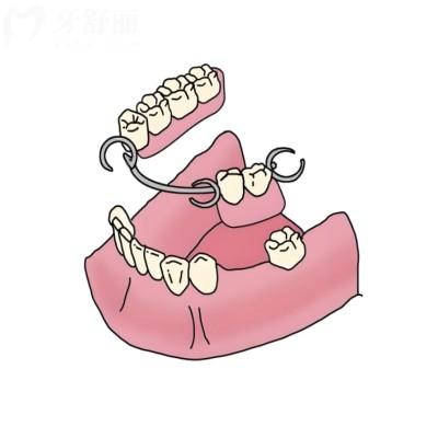 推薦沈陽(yáng)牙科全口吸附性義齒牙科:德立聯(lián)合/九諾/京科口腔技術(shù)靠譜