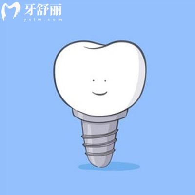 德國ABT種植體壽命多少年?揭秘ABT種植體優(yōu)缺點及收費價格