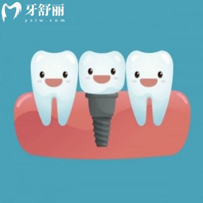 廣州看牙醫(yī)院哪家比較好?上榜的這幾家都是正規(guī)口腔機構(gòu)快收藏
