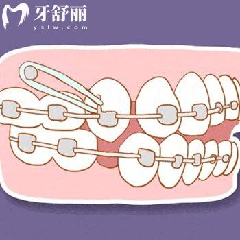 北京豐聯(lián)麗菁口腔門診部是正規(guī)私立口腔,有徐寶華正畸技術(shù)很出名可約