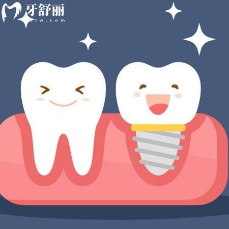 沈陽口腔醫(yī)院種植牙多少錢一顆?2025種植牙集采價(jià)格便宜單顆1680+半口20000+