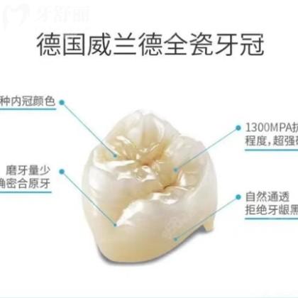 如何辨別威蘭德全瓷牙真假？3招教你輕松辨別威蘭德全瓷牙真假，再也不怕被坑！