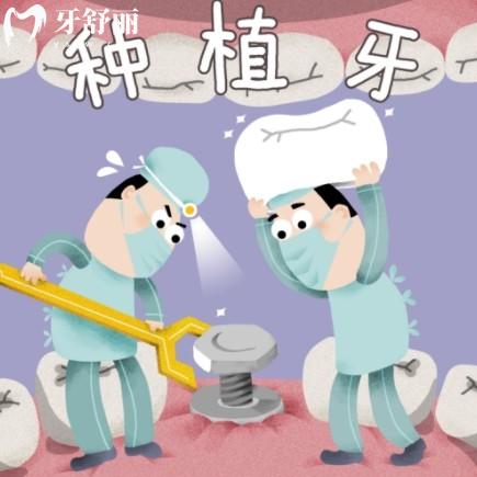 西班牙泰科種植體高端嗎？深扒材質(zhì)、技術(shù)細節(jié)，真實數(shù)據(jù)告訴你值不值