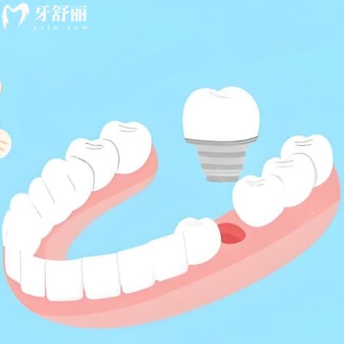 哈爾濱牙科醫(yī)院哪個(gè)便宜又好?這六家技術(shù)靠譜/價(jià)格透明/看牙不踩坑！