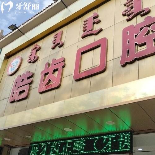 烏海皓齒口腔洗一次牙多少錢？80元起還有補(bǔ)牙種牙報價