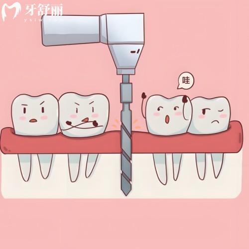 佛山2025版種植牙價(jià)格表在線(xiàn)公開(kāi):國(guó)產(chǎn)5000+美國(guó)8800+德國(guó)9000+瑞典10000+