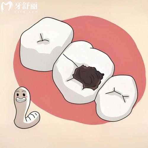 東莞比較出名的牙科醫(yī)院排名:莞大/好佰年/國貿(mào)/固德收費不貴技術賊好