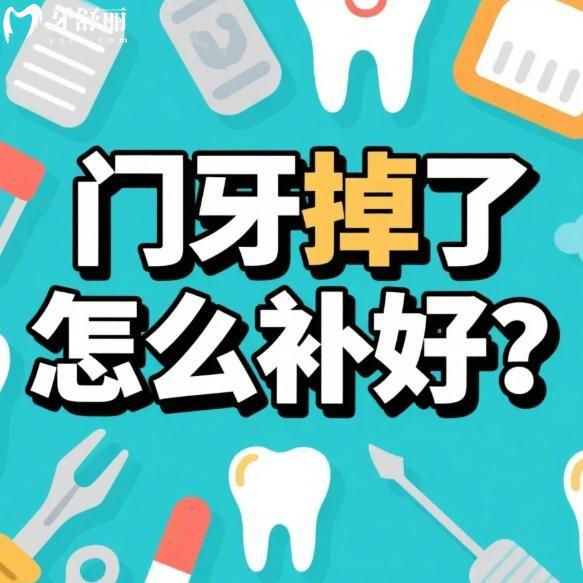 門牙掉了怎么補好?門牙缺失好的修復方法有哪些?門牙掉了怎么辦看過便知!