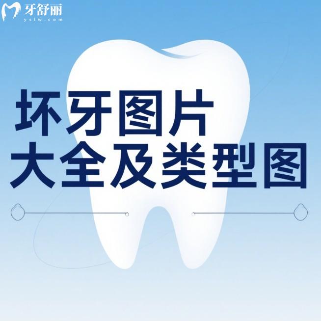 壞牙圖片大全及類型圖查看:揭秘不同壞牙的發(fā)展過程及治療方案