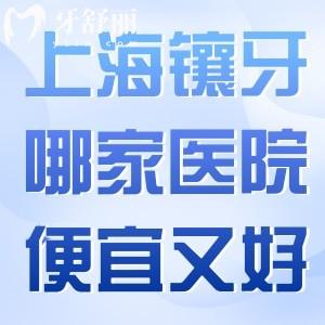 上海鑲牙哪家醫(yī)院便宜又好?分享上海鑲假牙技術(shù)口碑好的口腔醫(yī)院及收費標(biāo)準(zhǔn)