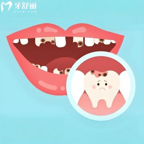玉環(huán)市種植牙醫(yī)院哪家好?惠康/晟達/中一/孝聰均是當?shù)卣?guī)靠譜口腔醫(yī)院