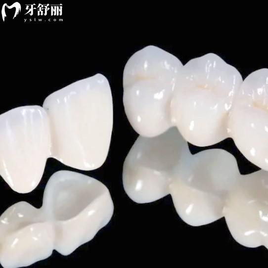 牙冠國產(chǎn)VS進(jìn)口：是智商稅還是物有所值？教你按牙選材不花冤枉錢