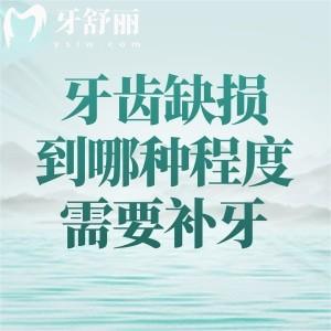 牙齒缺損到哪種程度需要補(bǔ)牙？材料怎么選？2025全新補(bǔ)牙價(jià)格全解析！