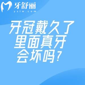 牙冠戴久了里面真牙會壞嗎?盤點牙冠一般壽命是多久及牙冠更換周期建議