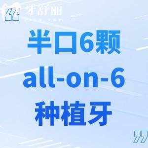 半口6顆種植牙的樣子圖片分享!對(duì)比半口4顆種植牙更加穩(wěn)固優(yōu)勢(shì)滿滿