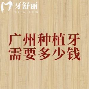 廣州補(bǔ)貼后種植牙需要多少錢？2025年廣州種植牙（單顆/半口/全口）價(jià)格已下調(diào)