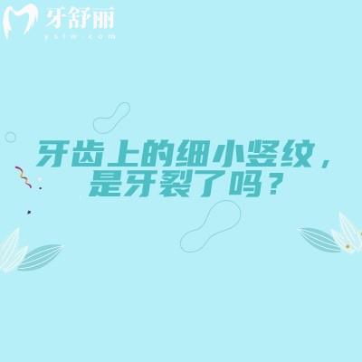 牙齒上的細小豎紋，是牙裂了嗎？一篇看懂不用慌