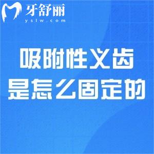 吸附性義齒是怎么固定的?詳細(xì)工作原理及適應(yīng)人群一文分享