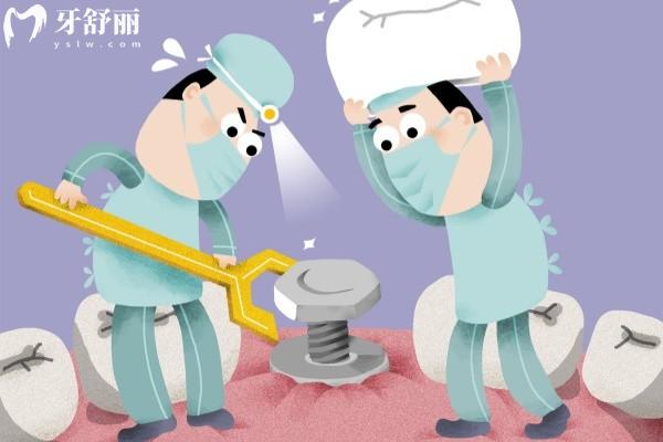 種牙對味覺有影響嗎？你可能想多了，關(guān)鍵其實在這幾點